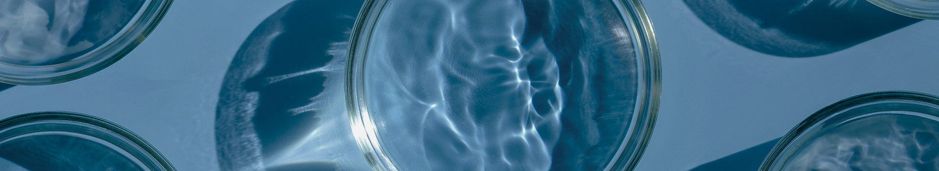 Laboratory glass dishes symbolizing clinical trials and data-driven consulting